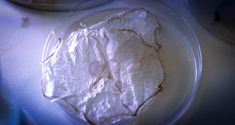 dried jellyfish in petri dish.jpg